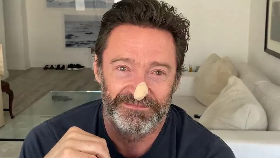 Hugh Jackman Urges Sunscreen Use After Skin-Cancer Scare featured image