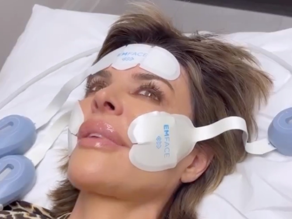 Lisa Rinna Says Her Face Is “Fresh as a Daisy” After This In-Office Treatment featured image