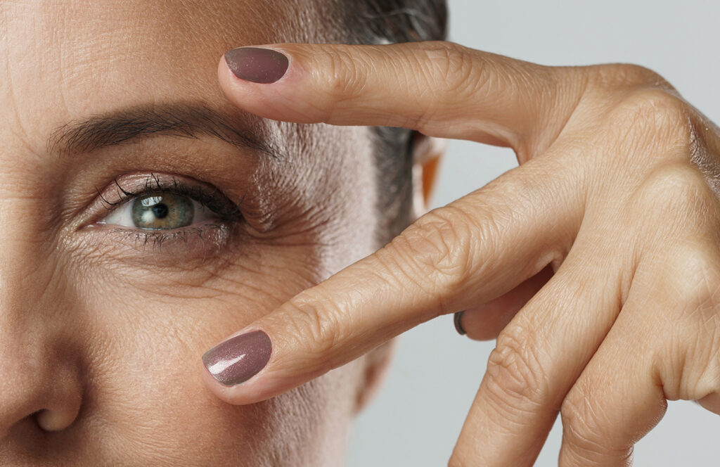 Everything to Know About Tear Trough Filler For Erasing Under-Eye Bags featured image