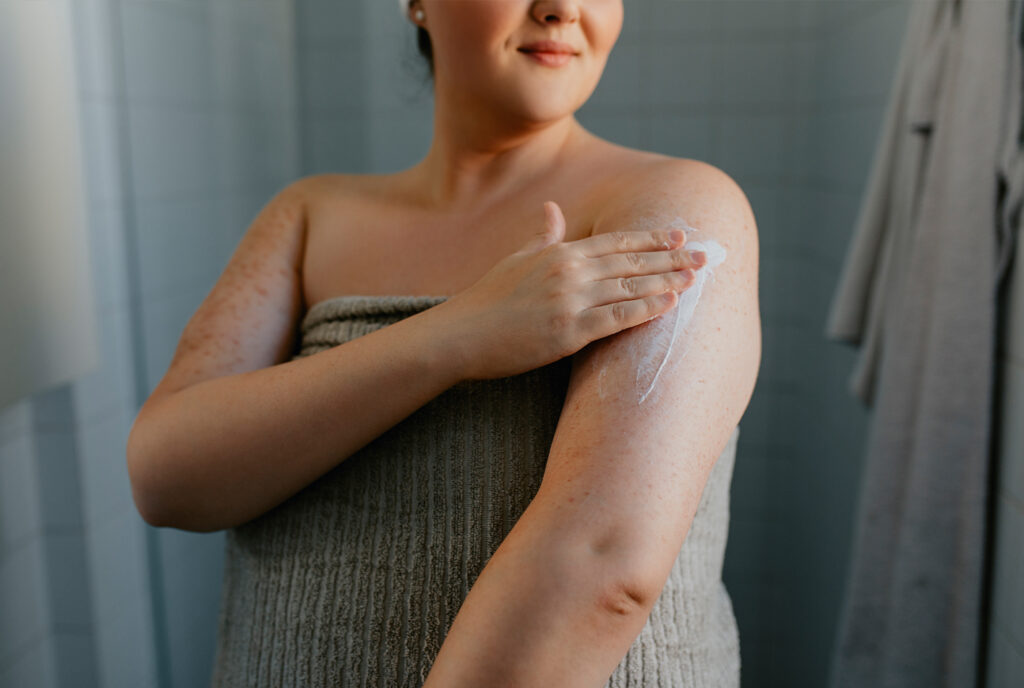 Experts Share Tips to Treat Keratosis Pilaris at Home featured image