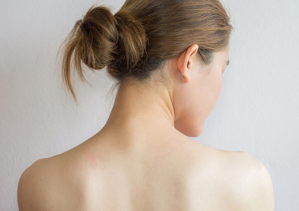Trapezius Botox: Pros and Cons of the Trending “Trap Tox” featured image