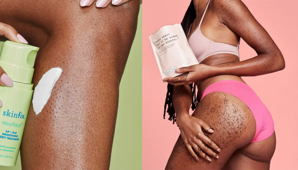 13 Body-Smoothing Products to Tackle Everything from KP to Stretch Marks featured image