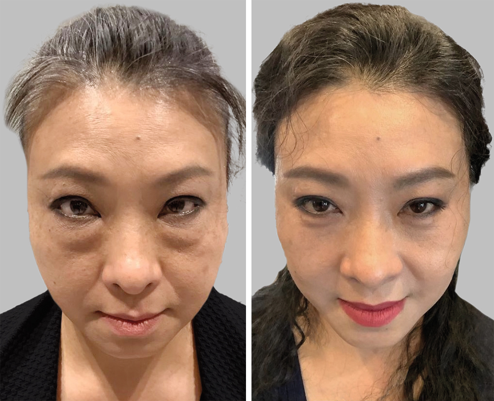 , 7 Important Facts to Know About Facial Balancing, According to a Facial Plastic Surgeon