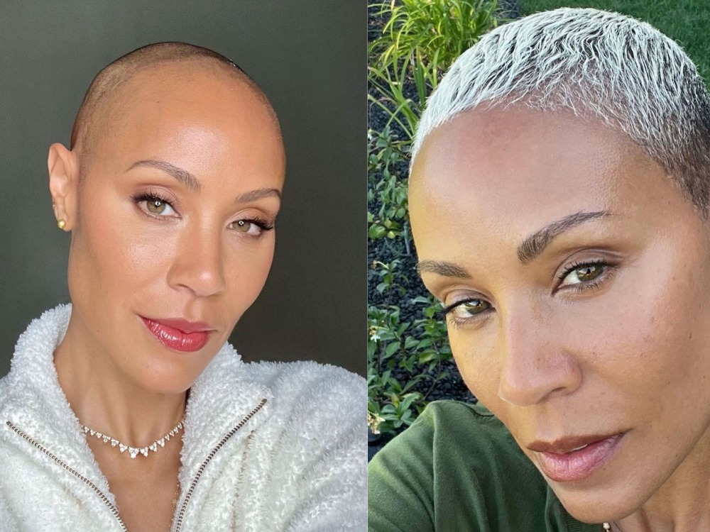 Jada Pinkett Smith’s Alopecia Journey: The Star Shares an Update featured image