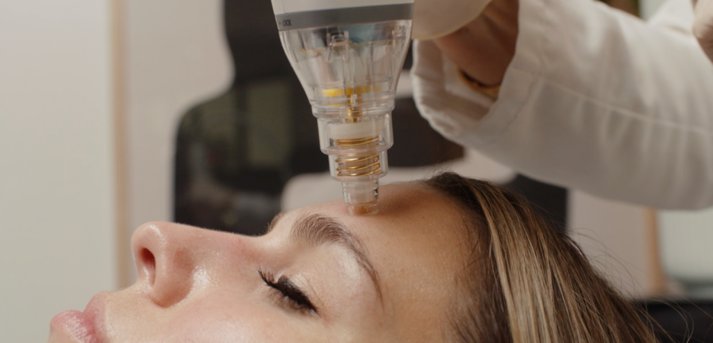 5 Things You Didn’t Know RF Microneedling Could Do For Your Skin featured image