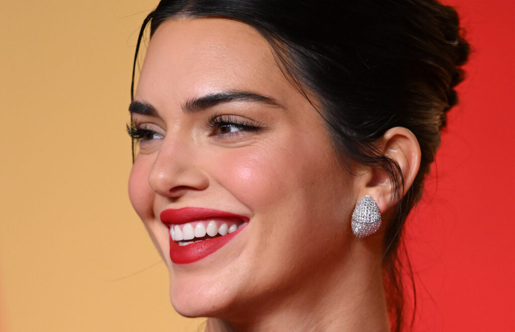 The Cosmetic Treatment Kendall Jenner Loves for Her Acne Scarring featured image